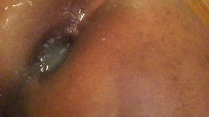 Ms300 Sarazia Exotic: Anal gaping with Ms300