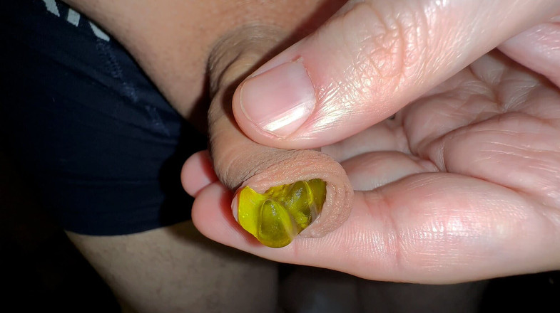 Wichskumpel: Sulu Küçük Yarak Sünneti Oyunları