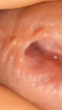 Big Sexy Hole Being Opened to the Extreme.
