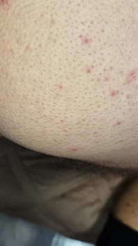 A Stranger with Cum in His Ass From a Hot Fuck with His Stepdaddy