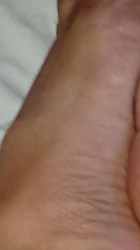 Gresopio nei piedi maschili 16