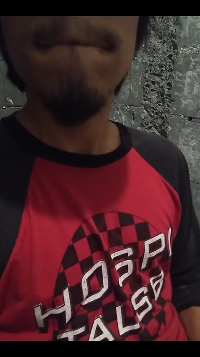 AlexAlejandro13: मरोड़ते