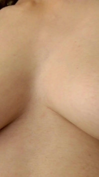 Tepels Close-up