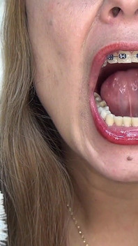 I Swallow a Condom Full of Colored Balls!!