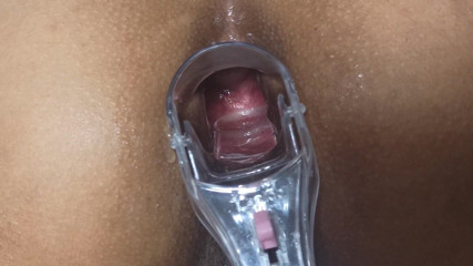 Xamy_97: Anüsümde spekulum bölüm 1