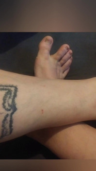 My Feets!