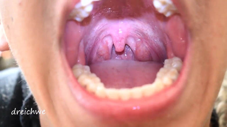 Dreichwe: Uvula fetisj mond
