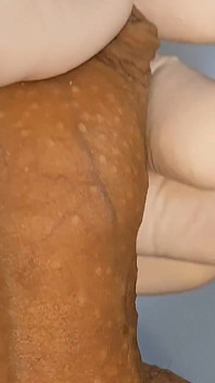 In a Doctor's Office I Apply Hot Glue to My Dick.