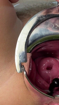 Crazywifeslut Cervix a Peehole Play