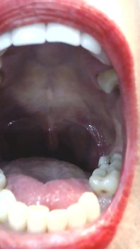 내 큰 입 혀 이빨 이복 누이 Uvula 내부