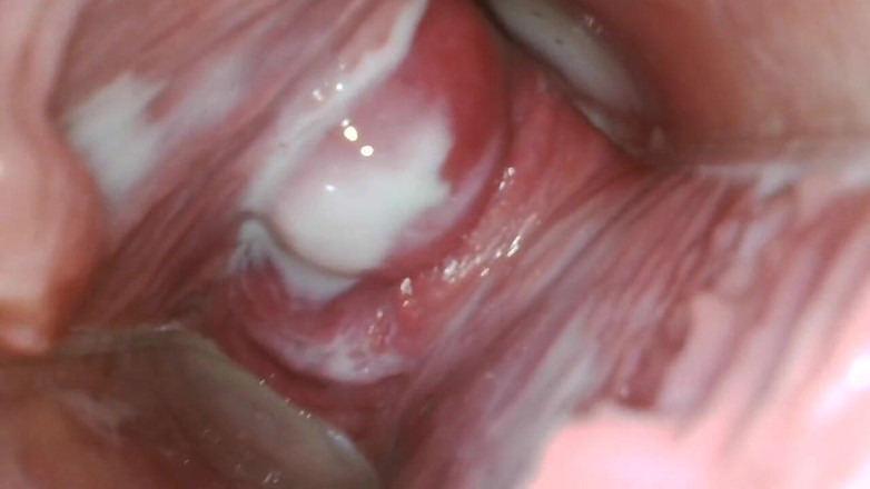 JANA studios: Endoscopio en mi coño