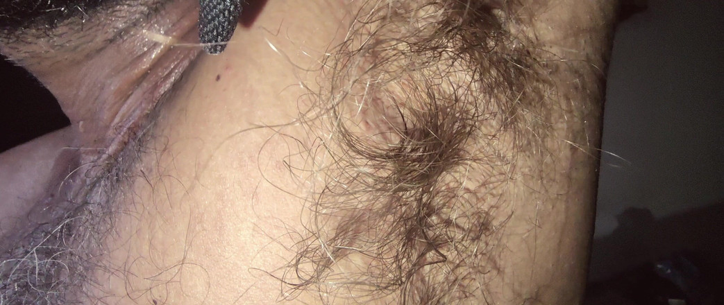 Stink HairyMale: 여기는 매우 뜨겁습니다