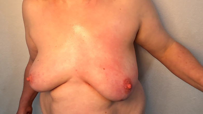 Bouncy Tits Action: 500 ciosów na lewym cycku aż spuchnięty