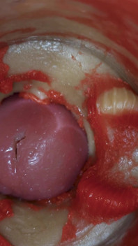 Inside POV Camera Captures an Intense Climax