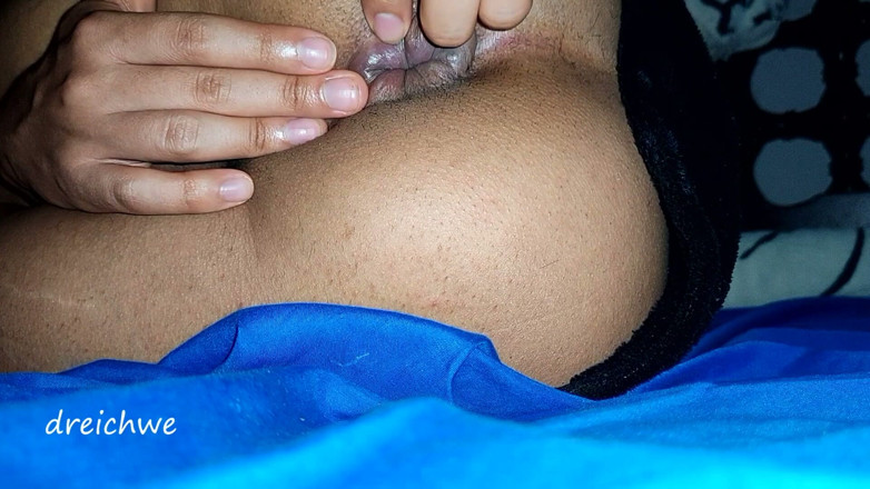Dreichwe: Hemorrhoids in the Ass