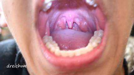 Dreichwe: Uvula fetish mouth
