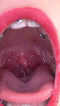 Vídeo de fetiche na boca com Bara mostrando aparelho dental.