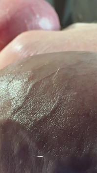 Pijat testis