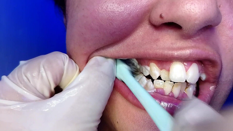 Elimoon: Aku lagi asik sikat gigi sambil pamer tubuh aduhainya (close-up)