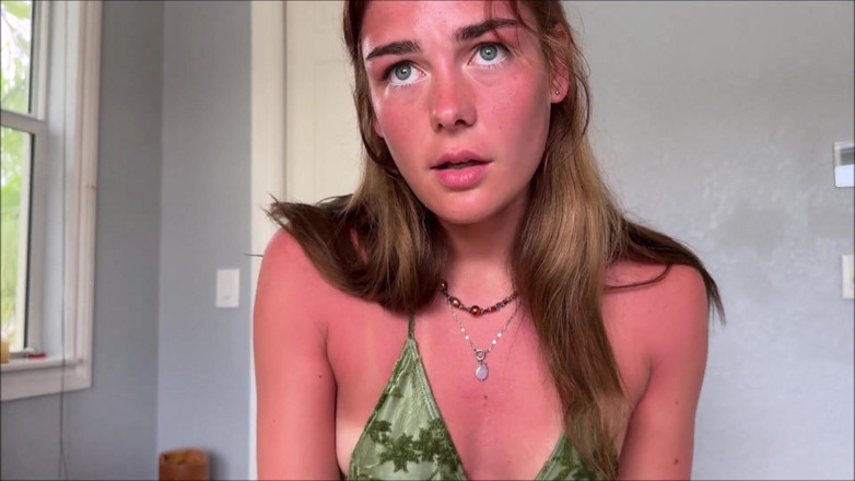 Alex Adams: Little Stepsister's Sunburn Accident - Arabella Rose - Family Therapy