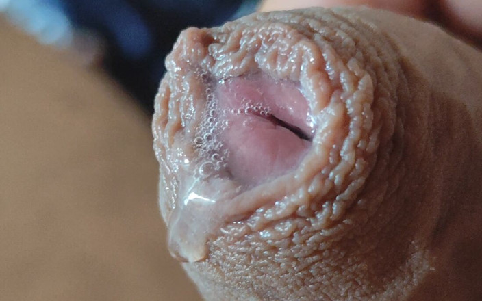 Straight Daddy Club: Deep Split in the Glans Produces Bubbling Liquid