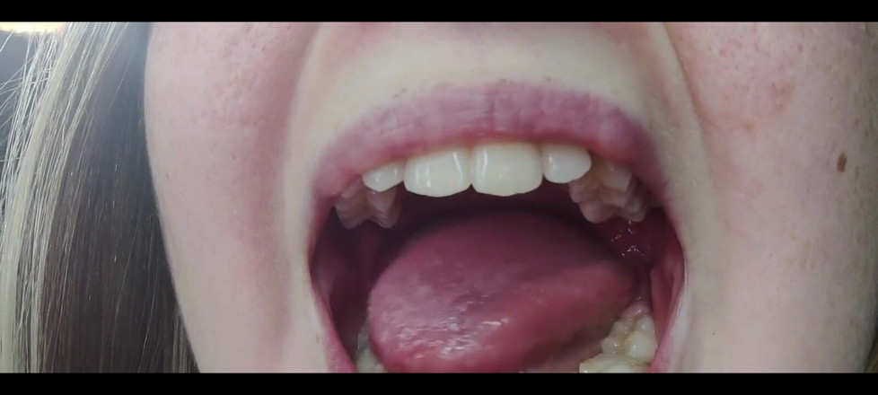 RavenHearth666VIP: Hrdlo fetiš