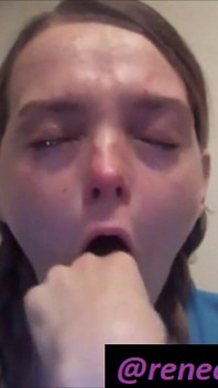Dávení na prsty