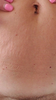 My Body