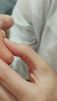 Harsh Penectomy for a Sexually Transmitted Diseases Stds