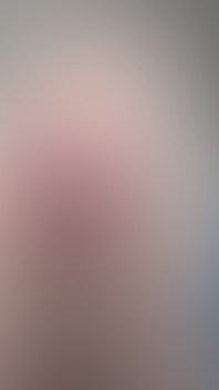 Hot Young Body and Anal Prolapse From Different Angles