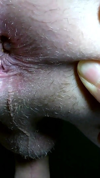 Mijn gat in close-up
