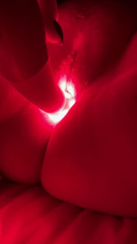 Vaginal Rejuvenation Red Light Stick