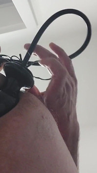 Analdehendes anal