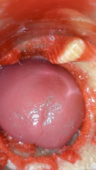 Sperma, Große Ladung Sperma. Ausgezeichnete Interne Kamera. 4K