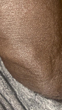 Meat Teaser