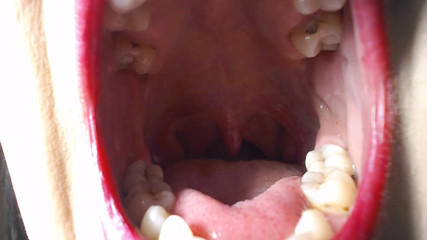 Abby Anna: Big wide open mouth