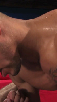 Rugburn