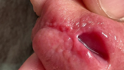 Leonardo-1974: Fingrar i Penis. Hål i penispenetration.