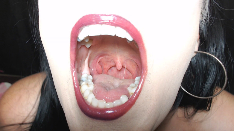 Abby Anna: Super prohlídka úst, všechno