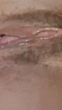 Dilation