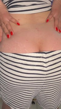 Scoreggia in pigiama buttcrack