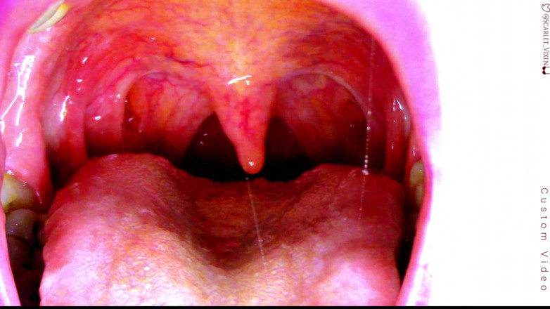 Scarlet Vixen: Sexy scarlet sagt Ahhhh - uvula zeigt