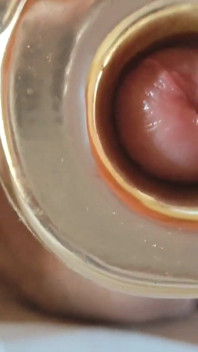 Boy Close up Tight Uncircumcised Glans Excited