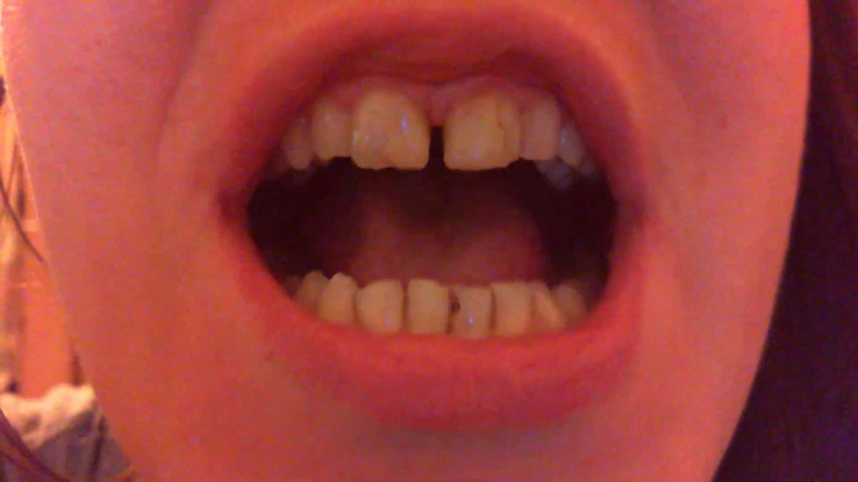 Nicoletta Embassi: Teeth Fetish Devour