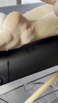 The Lollipop Couldn’t Handle the Pressure