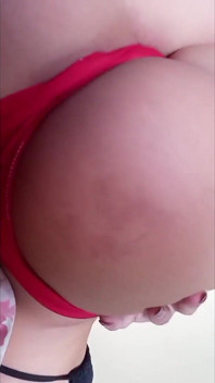 My Butt Cheek Got Purple From a Spanking
