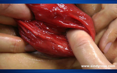 Sindyrose: Sindy Rose Anální Fisting & Prolapse Extreme s mr.play