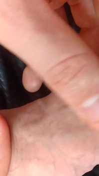 Tight Foreskin Large Cock Play- Playing with My Uncut Foreskin Phimosis Cock