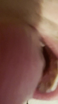 Tongue Crazy