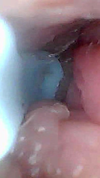 Visuele Gids Voor Stimulatie En Orgasme Van De G-spot - Endoscopisch Perspectief